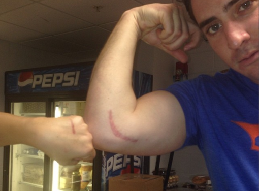 The Matt Harvey Non-Story