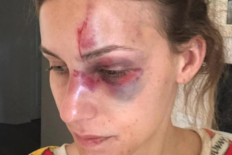 Opinion: Domestic Violence and Abuse in Sports